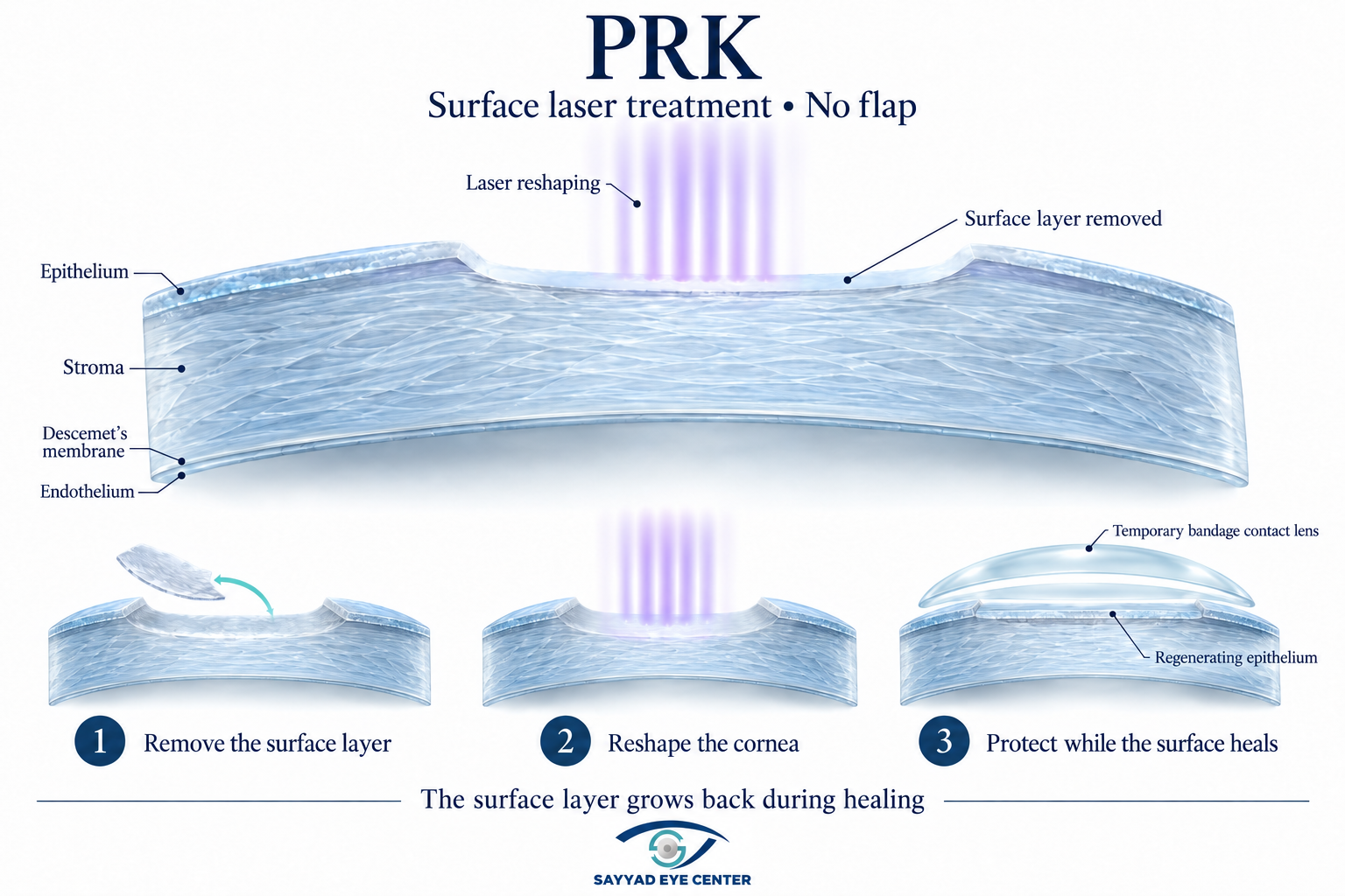 Prk
