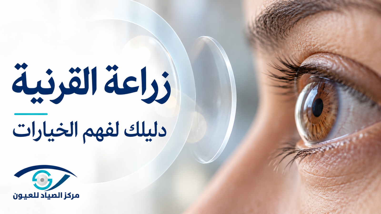 زراعة القرنية