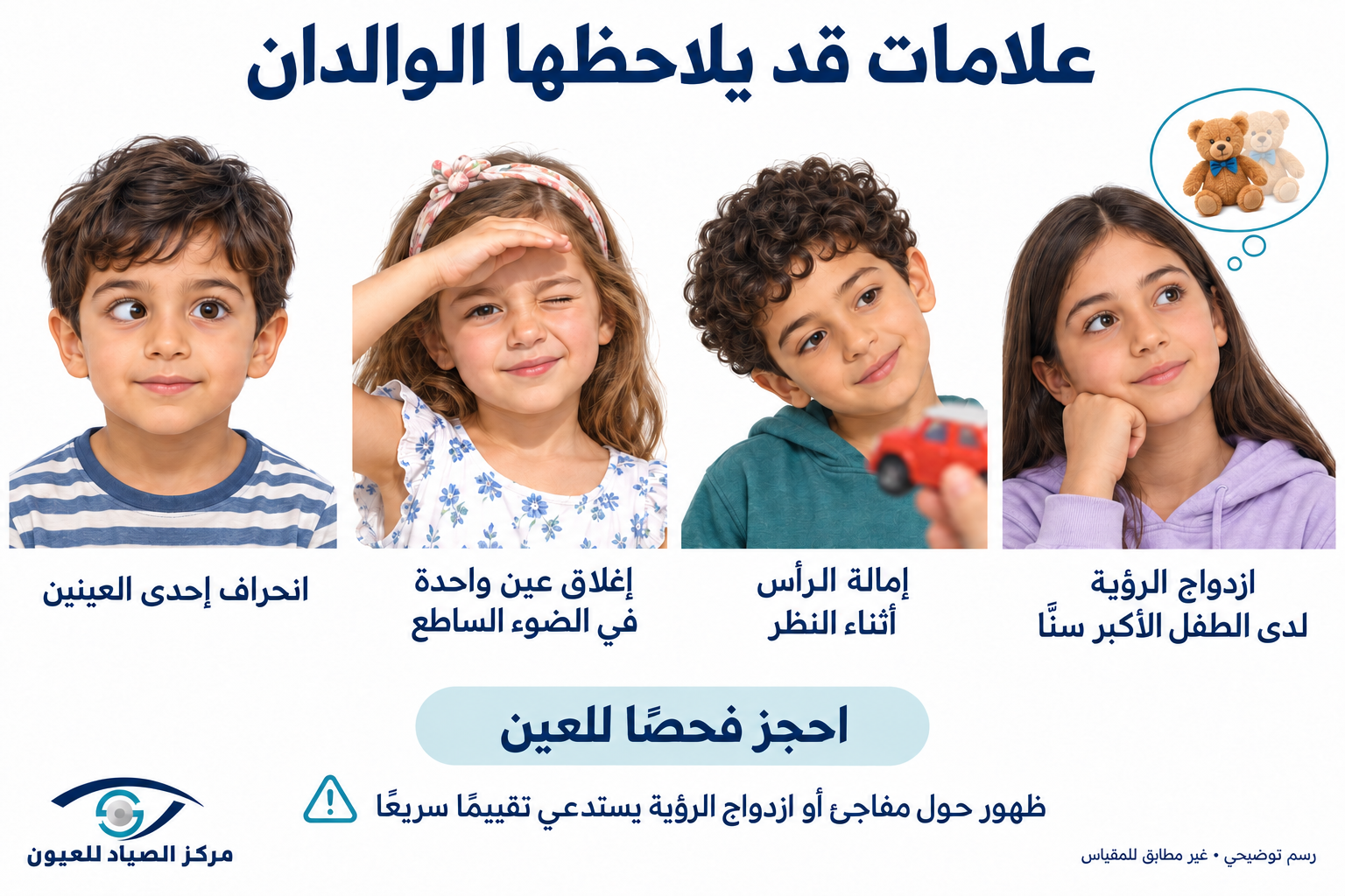 علامات الحول عند الأطفال