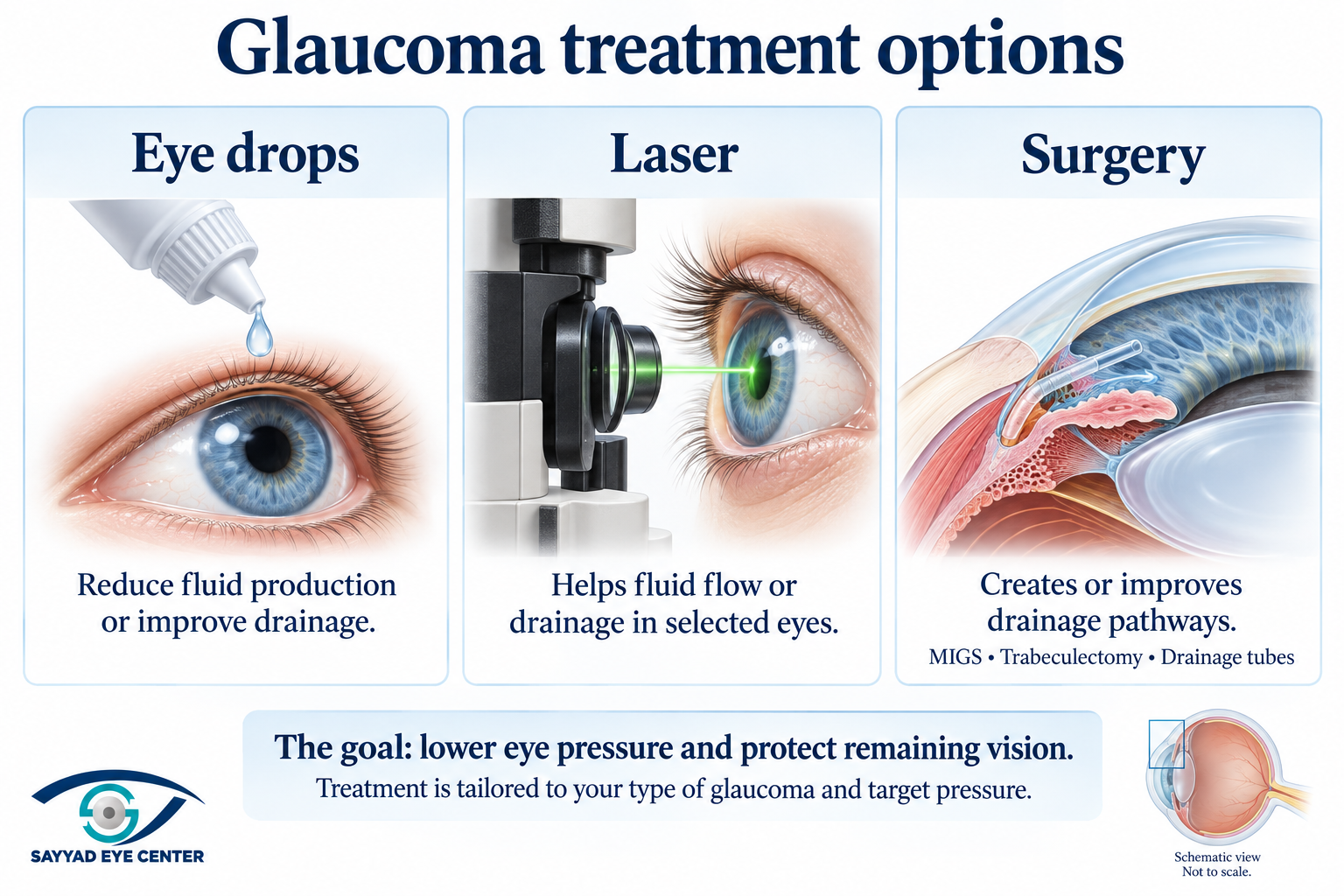 Treatment options