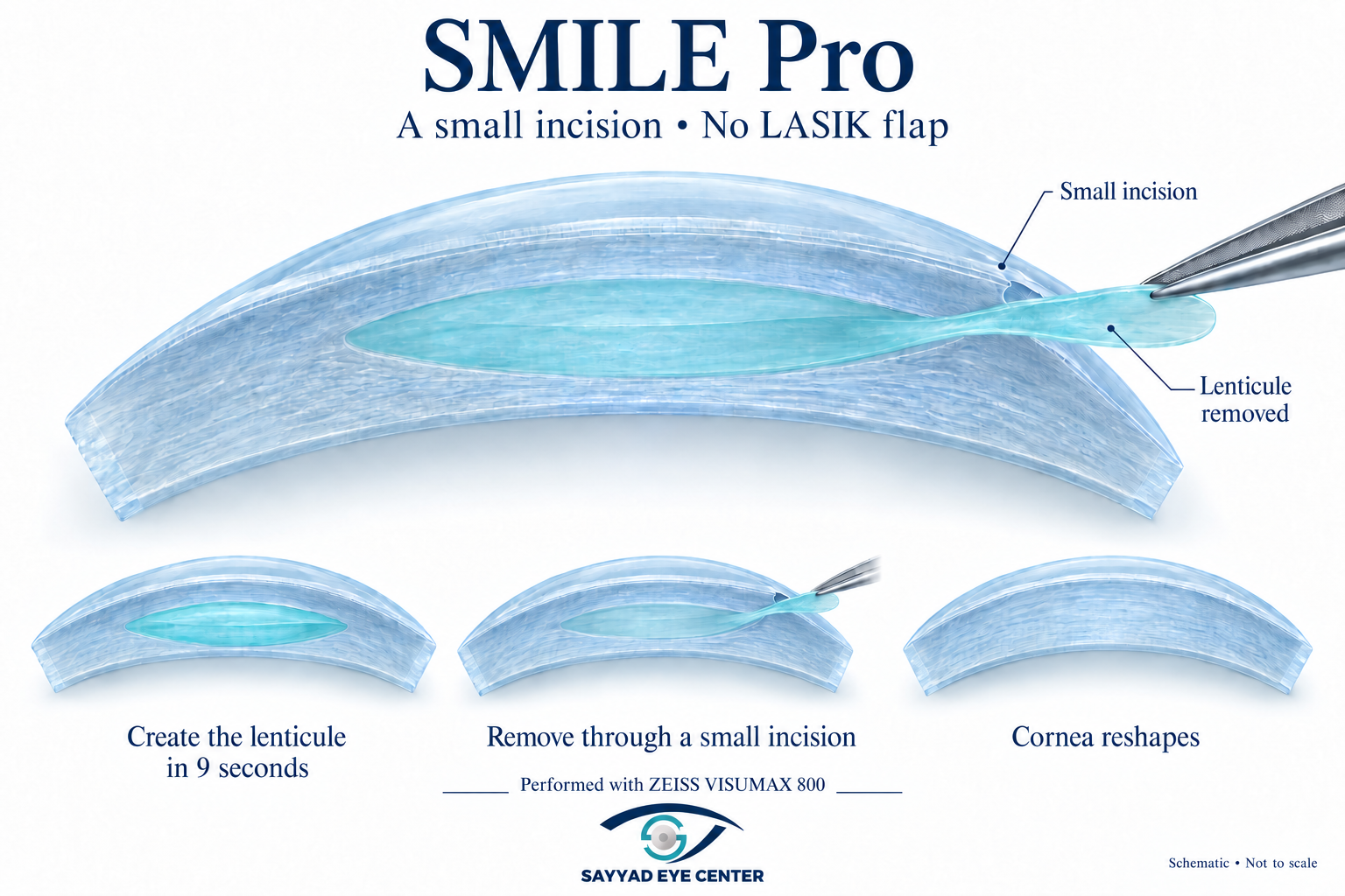 Smile pro
