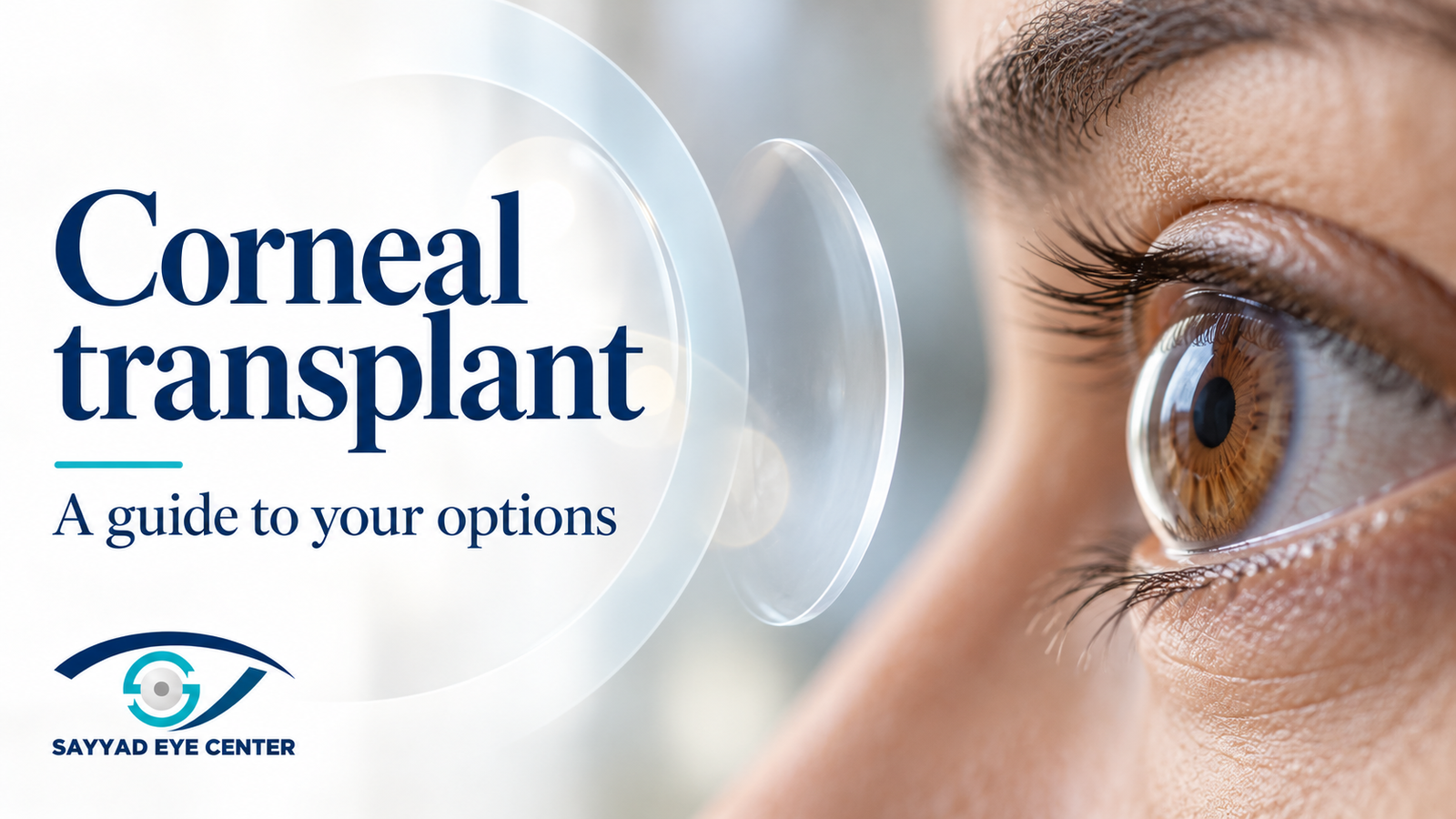 Corneal Transplant Surgery
