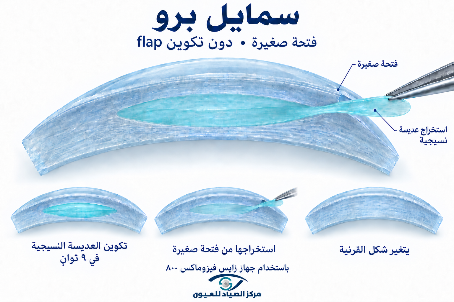 تقنية سمايل برو