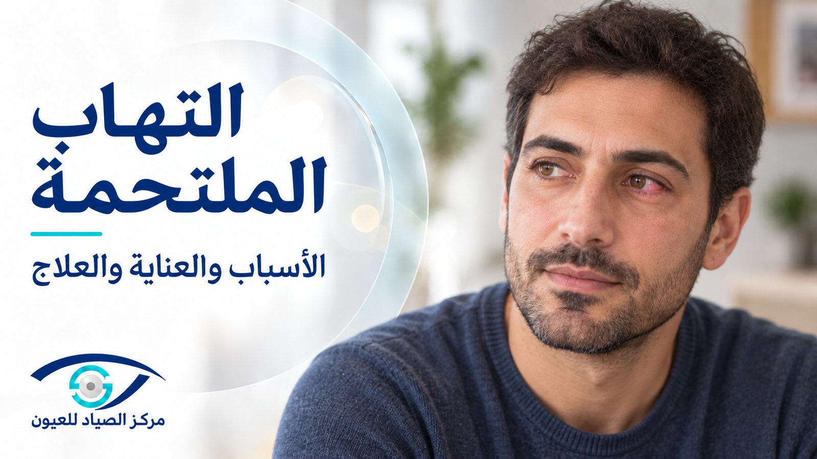 التهاب الملتحمة: الأسباب والعلاج ومتى تحتاج إلى فحص