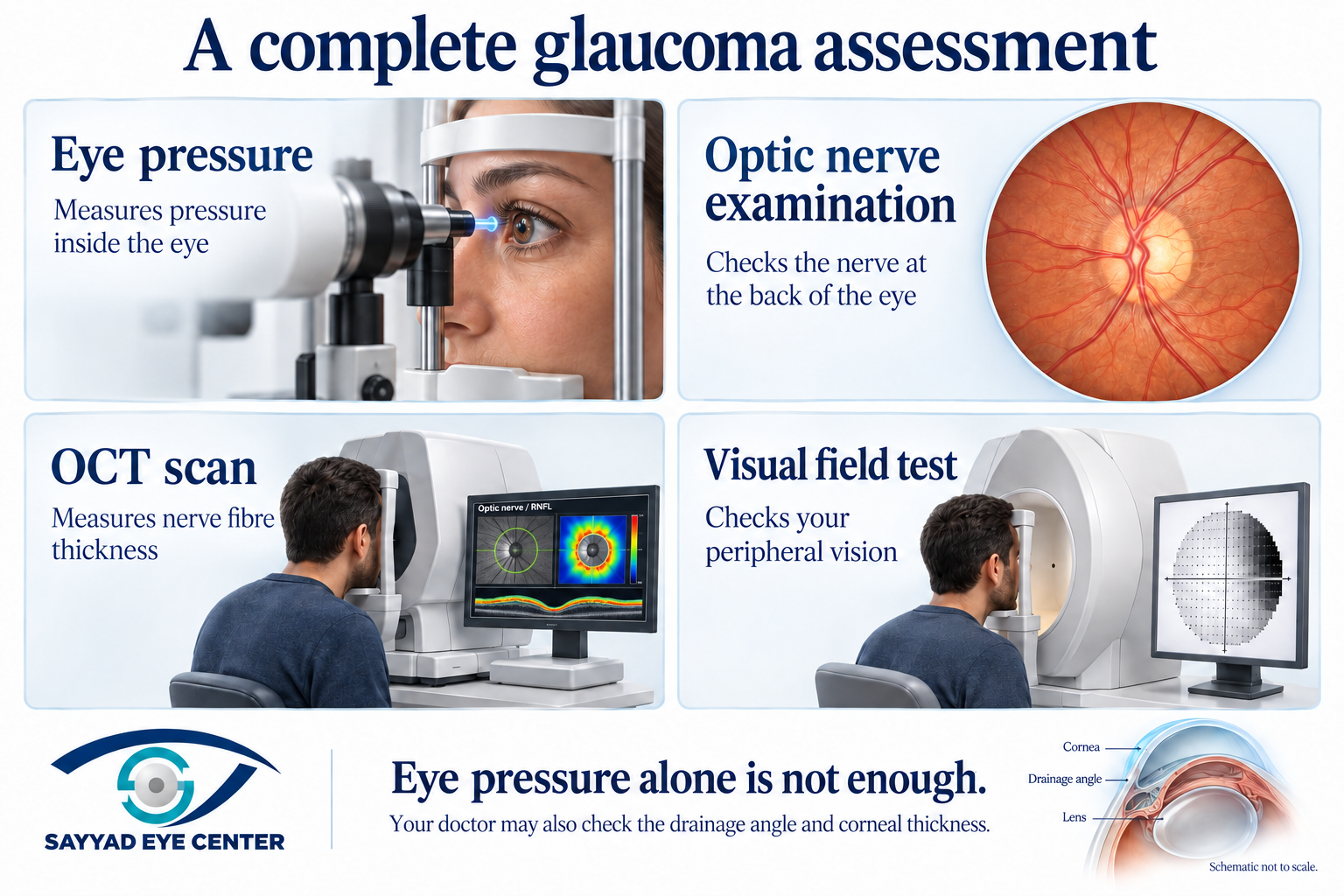 Glaucoma tests